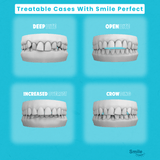 Night-Time Single Arch - Smile Perfect